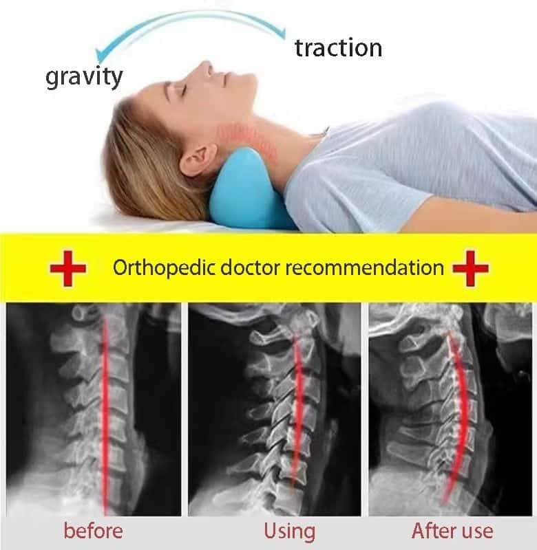Neck Hump Corrector Neck Massage Pillow Correction Artifact Sleeping Special Neck Relaxer Support Traction - Image 4