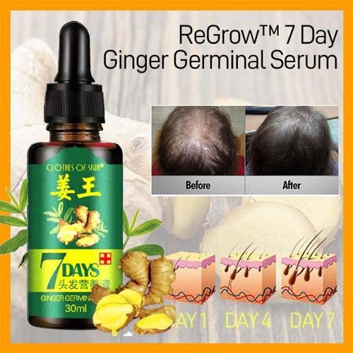 7 Day Ginger Germinal Oil Hair Nutrient Solution Hair Growth Essence Liquid Fast Natural Hair Loss Treatment Hair Care