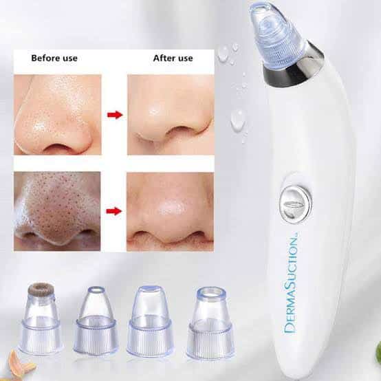 Derma suction Blackhead Remover Vacuum Acne Cleaner Black Spots Removal - Image 2