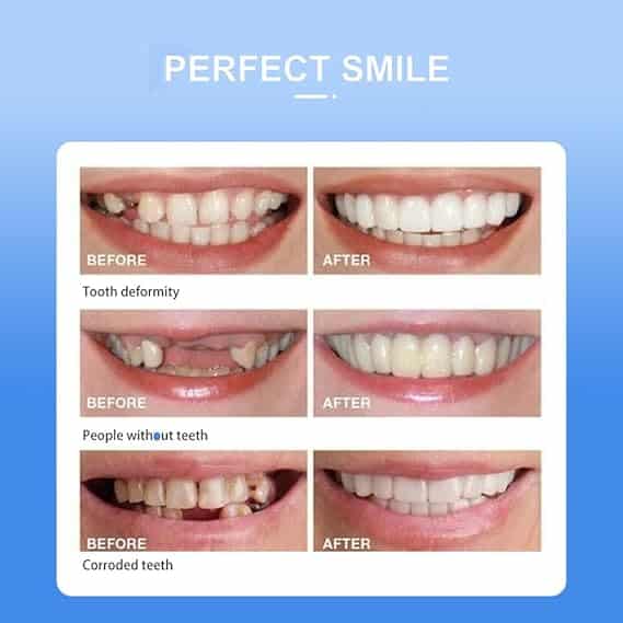 Snap On Smile Veneers Teeth For Men And Women Moldable False Artificial Braces Teeth - Image 4