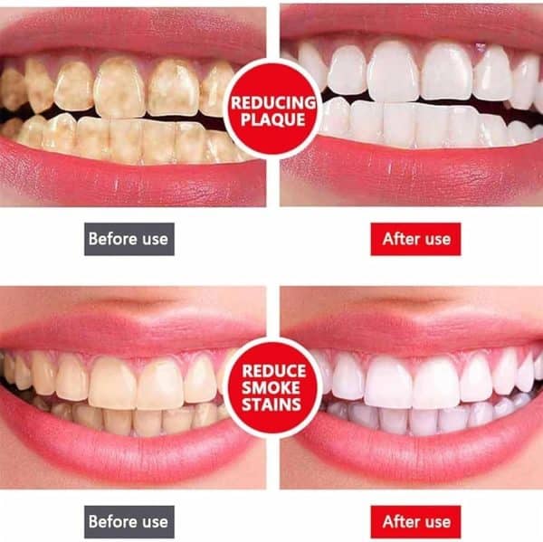 Yayashi Sp-4 Ultra Whitening Toothpaste Probiotic Stain Remover / Stain Removing Toothpaste, Protects Gums Freshens Breath, For Everyone - Image 3